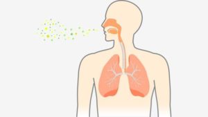 Objawy zapalenia płuc mogą obejmować.