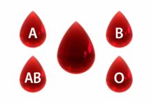 Ako zistiť krvnú skupinu