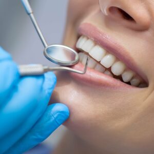 Čistenie zubov: Dôležitý prvok dentálnej hygieny